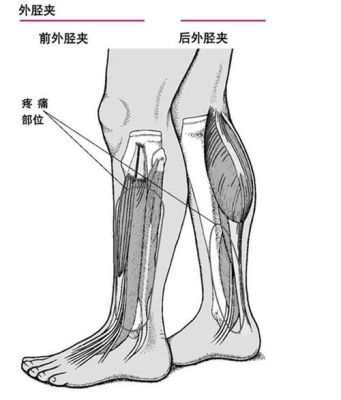 左小腿内侧肌肉叫什么（左小腿内侧肌肉和骨头之间疼）